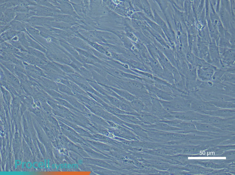 Human Pulmonary Artery Smooth Muscle Cell Complete Medium - 6