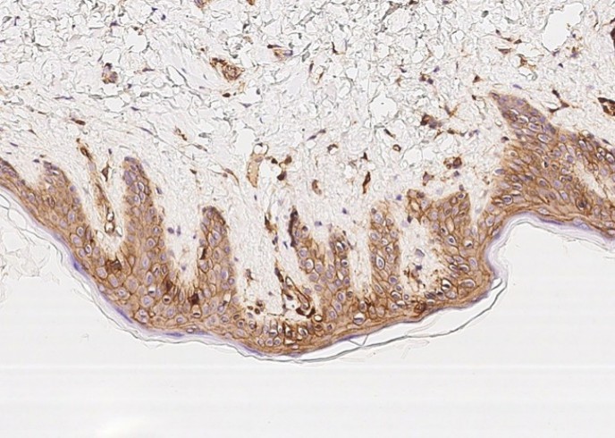 Beta-2 microglobulin/B2M Monoclonal Antibody - small - 4