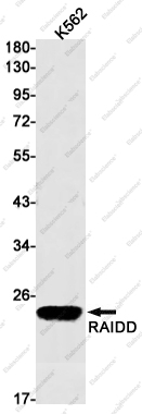 Recombinant RAIDD Monoclonal Antibody - 1