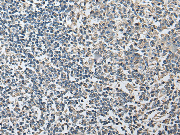 Immunohistochemistry of paraffin-embedded Human tonsil tissue  using PLA2G16 Polyclonal Antibody at dilution of 1:40(?200)