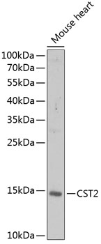 Western blot analysis of extracts of mouse heart using CST2 Polyclonal Antibody at 1:1000 dilution.