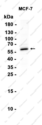 Recombinant CYP1B1 Monoclonal Antibody - 1