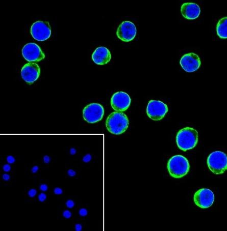 Recombinant TNF receptor II Monoclonal Antibody - small - 4
