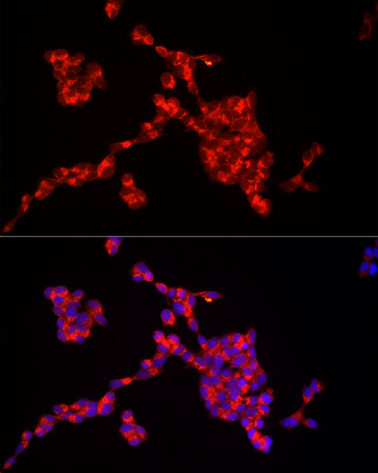 Immunofluorescence analysis of SH-SY5Y cells using IRS2 Polyclonal Antibody at dilution of 1:50 (40x lens). Blue: DAPI for nuclear staining.