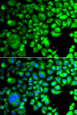 Immunofluorescence analysis of A549 cells using TBPL1 Polyclonal Antibody