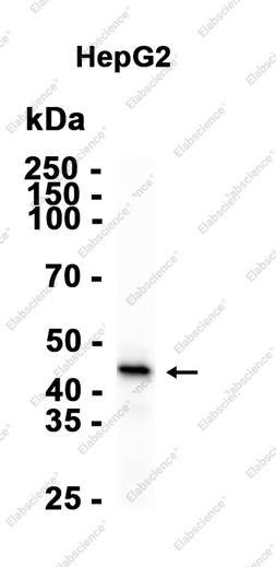 Recombinant Phospho-Pyruvate Dehydrogenase E1-alpha subunit (Ser293) Monoclonal Antibody - 2