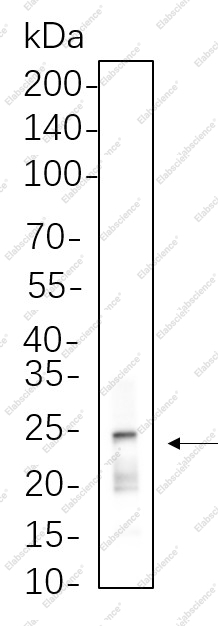 Recombinant Rab11 Monoclonal Antibody - 1