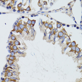 Immunohistochemistry of paraffin-embedded Mouse testis using HEXA Polyclonal Antibody at dilution of 1:100 (40x lens).