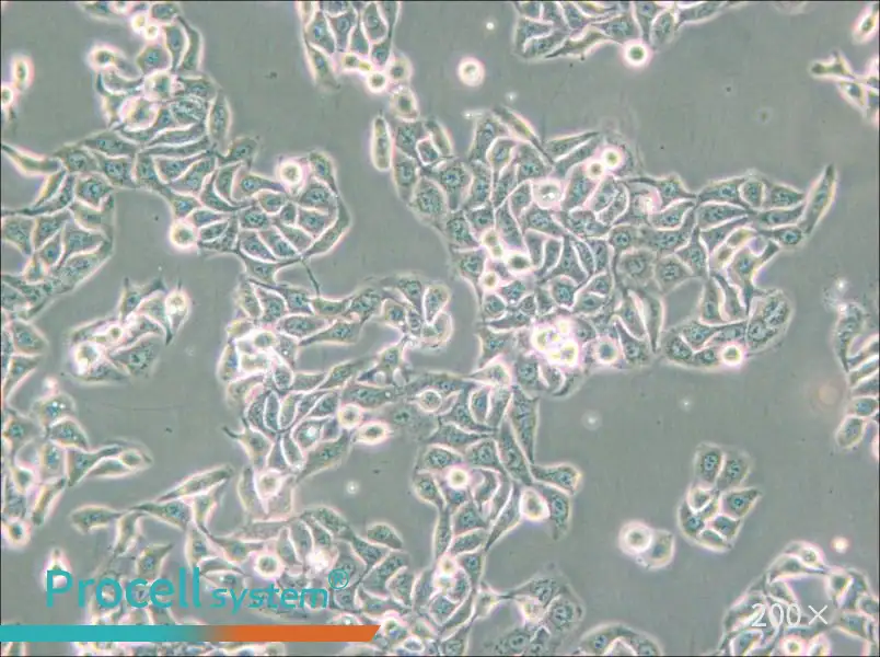 RT-112 Cell Complete Medium - small - 5