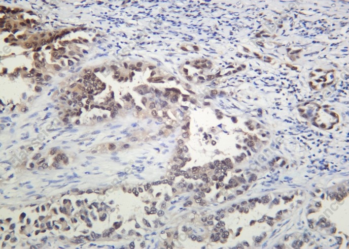 Recombinant Drosha Monoclonal Antibody - 2