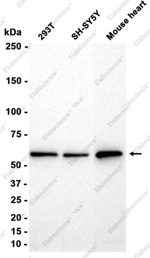 Recombinant Lipoamide Dehydrogenase Monoclonal Antibody - 2