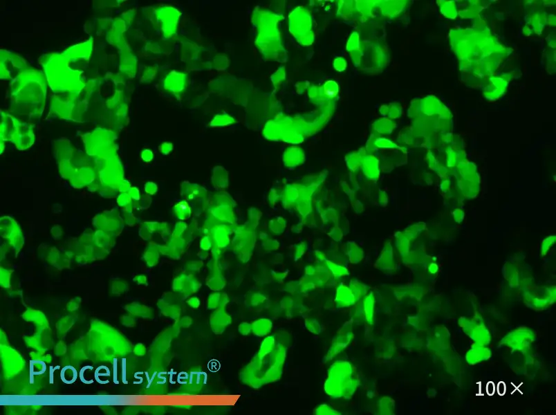 MCF7-LUC-EGFP Cell Complete Medium - 3