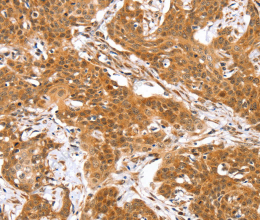 RGS22 Polyclonal Antibody - 2