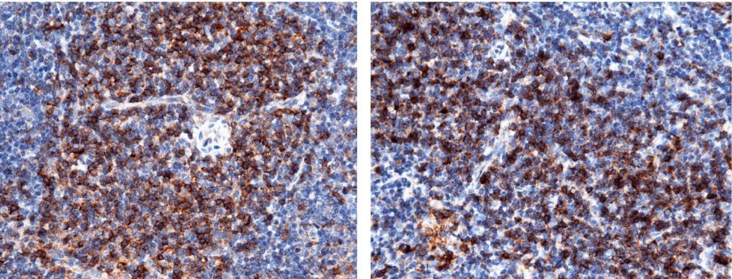 Recombinant CD4 Monoclonal Antibody-searchlist-1