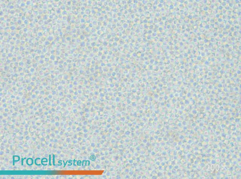 OCI-AML-2 Cell Complete Medium - 5