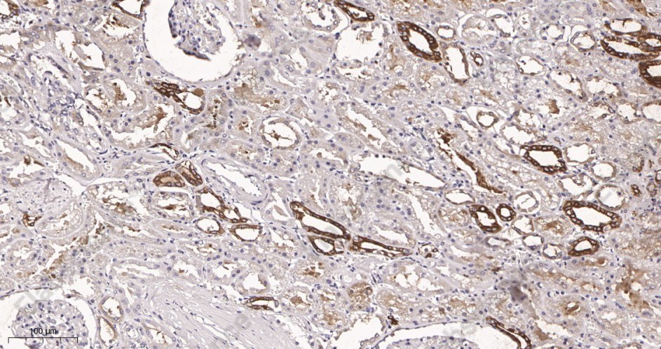 Recombinant PKM Monoclonal Antibody - 2