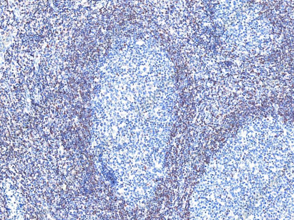 Recombinant Bcl-2 Monoclonal Antibody - 1
