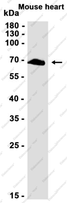 Recombinant Pyruvate Dehydrogenase E2 Monoclonal Antibody - 2