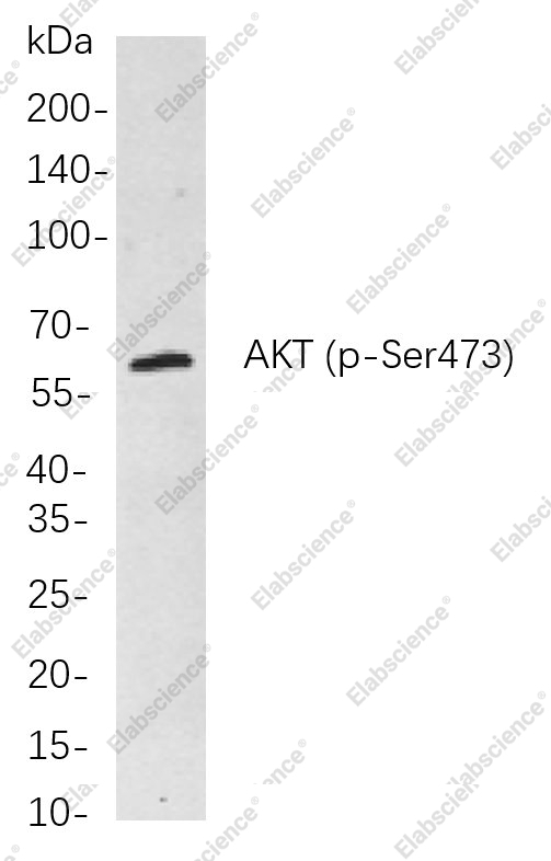 Recombinant Phospho-Akt (pan) (Ser473) Monoclonal Antibody - 1