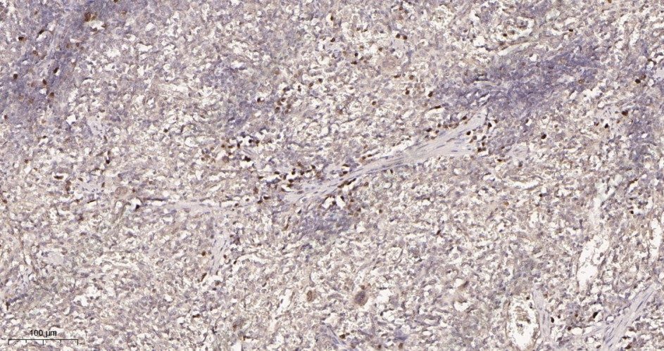 Recombinant XBP1 Monoclonal Antibody - 3