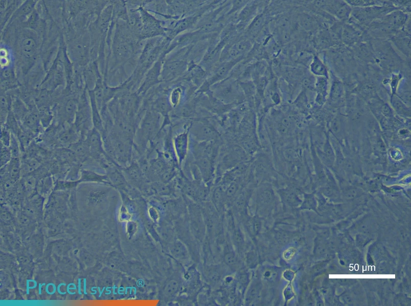 Mouse Retinal Muller Cells - 4