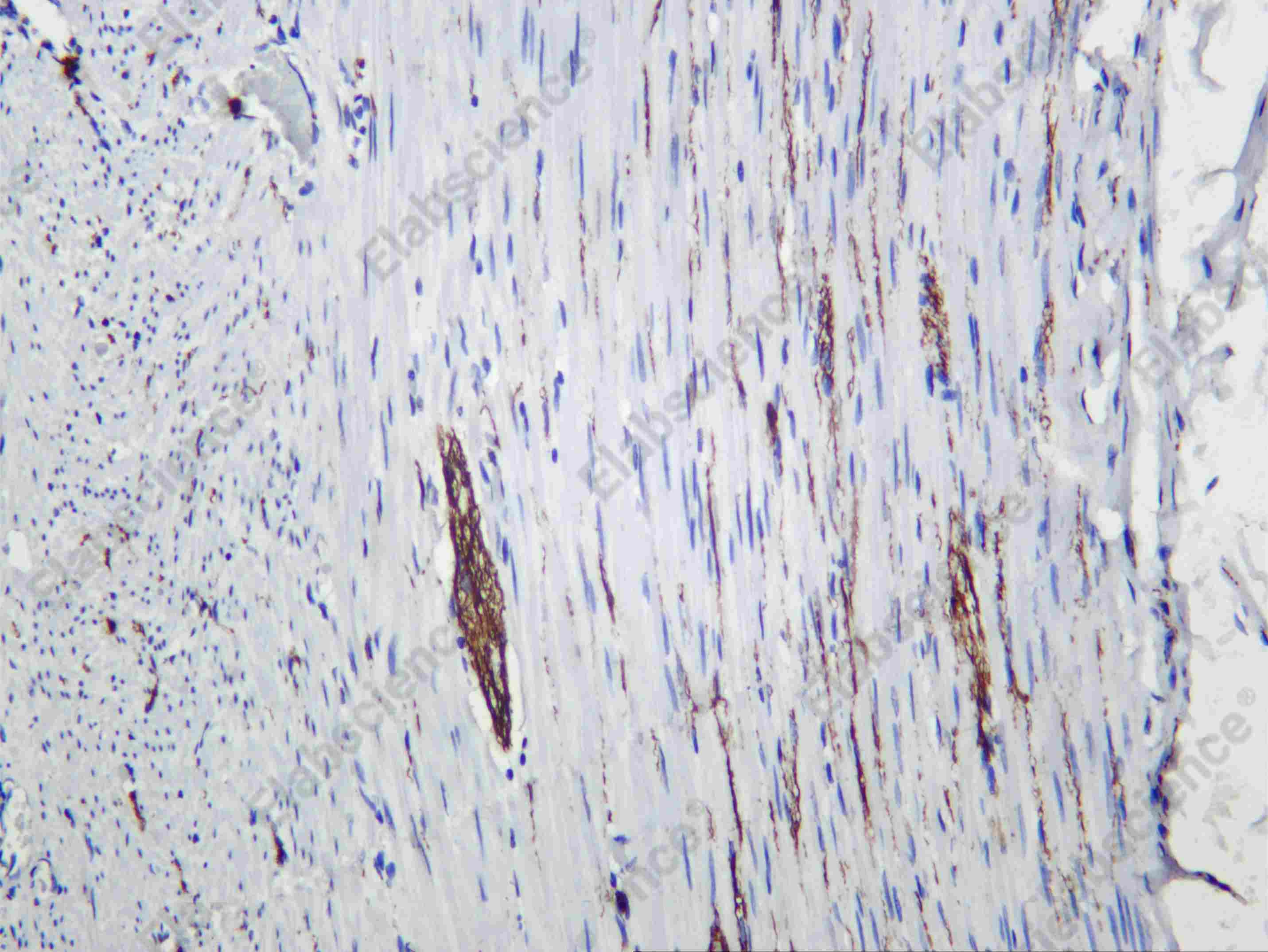 Recombinant Internexin α Monoclonal Antibody - 1