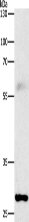 Western Blot analysis of Mouse lung tissue using FGF2 Polyclonal Antibody at dilution of 1:1000