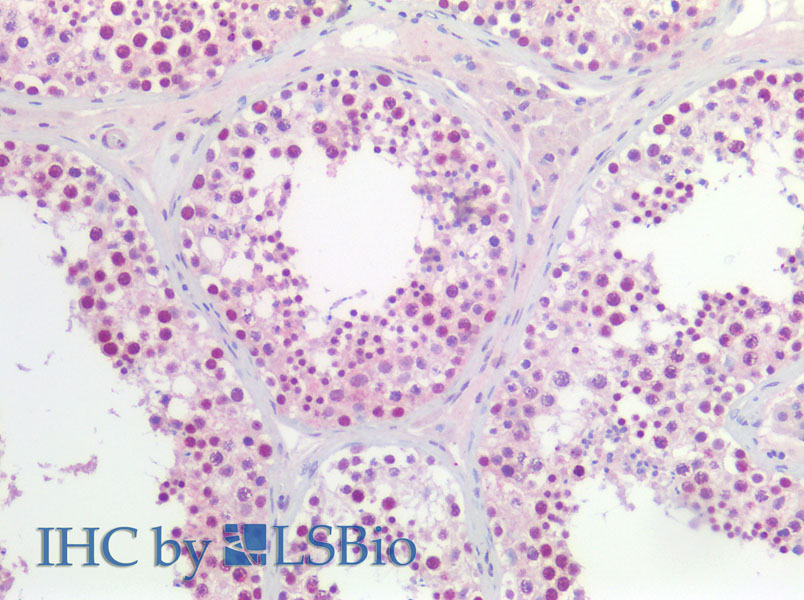 Immunohistochemistry of paraffin-embedded Human testis using CCNL2 Polyclonal Antibody at dilution of 1:200(Elabscience Product Detected by Lifespan).