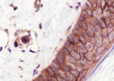Recombinant beta-2-Microglobulin Monoclonal Antibody-searchlist-2