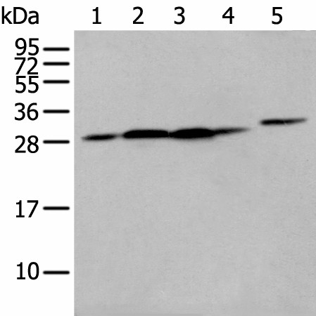 Western blot analysis of 293T cell Human fetal liver tissue A549 and Hepg2 cell  using FKBP7 Polyclonal Antibody at dilution of 1:400