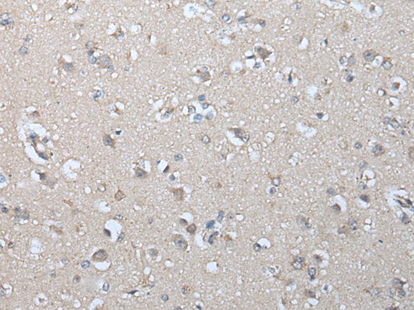 Immunohistochemistry of paraffin-embedded Human brain tissue  using IFNB1 Polyclonal Antibody at dilution of 1:45(?200)