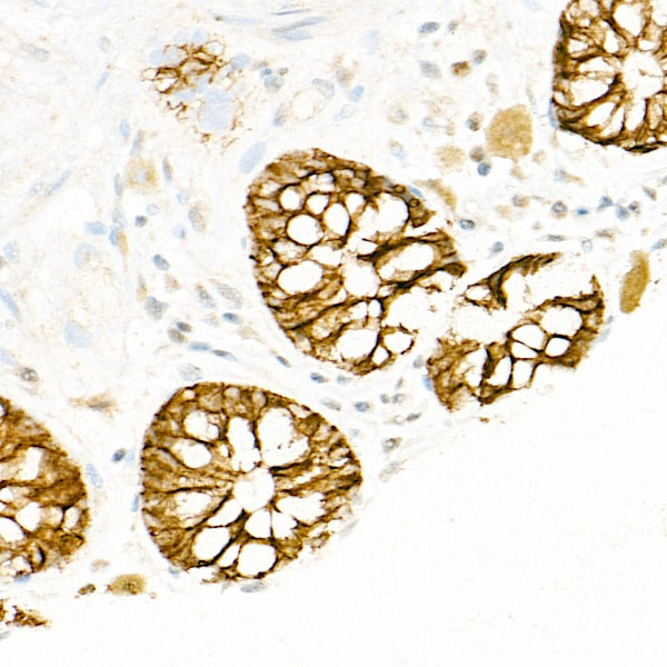 Immunohistochemistry of paraffin-embedded human colon using FXYD3 Polyclonal Antibody atdilution of 1:100 (40x lens).Perform high pressure antigen retrieval with 10 mM citrate buffer pH 6.0 before commencing with IHC staining protocol.