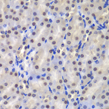 Immunohistochemistry of paraffin-embedded Mouse kidney using GSTP1 Polyclonal Antibody at dilution of 1:200 (40x lens).