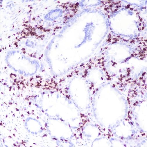 Recombinant CD2 Monoclonal Antibody-searchlist-1