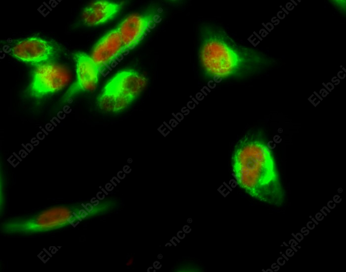 Recombinant STAT3 Monoclonal Antibody - 4