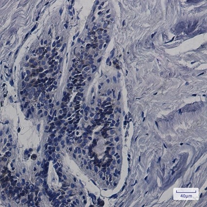 Recombinant CDK5RAP3 Monoclonal Antibody - 3