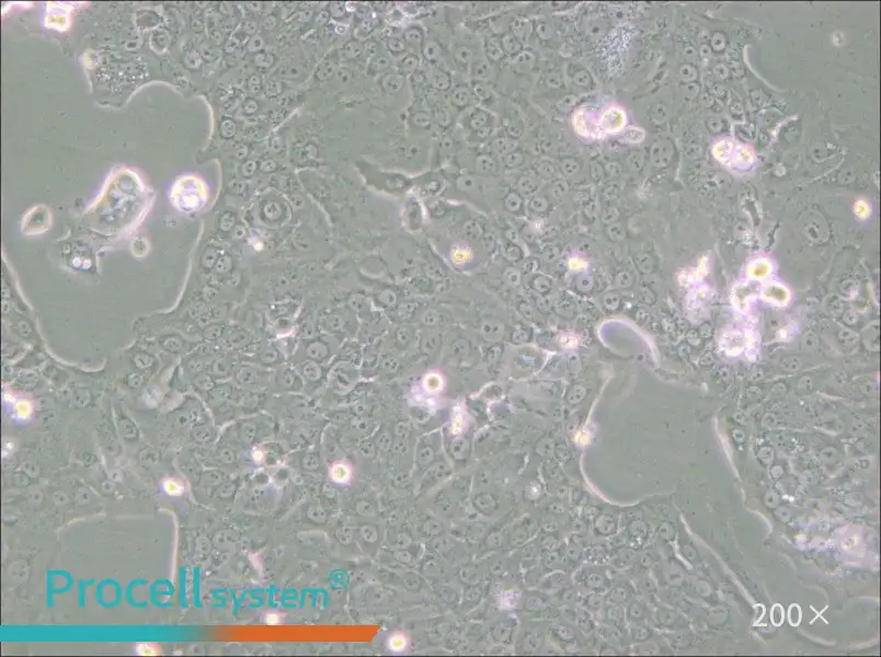 Capan-1 Cell Complete Medium - small - 4