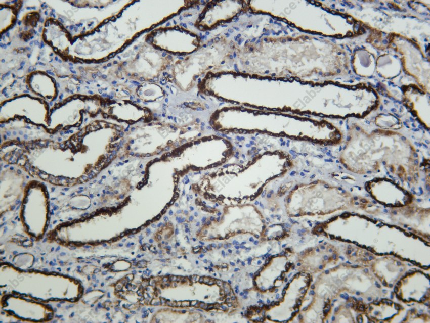 Recombinant SLC16A1 Monoclonal Antibody - 2
