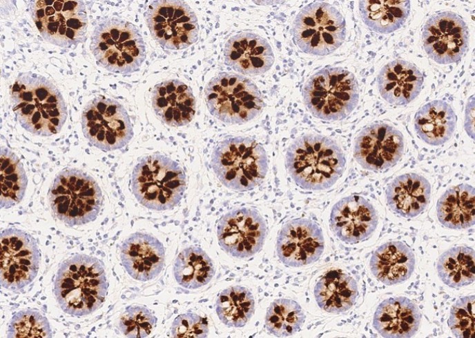 Recombinant REG4 Monoclonal Antibody - small - 1