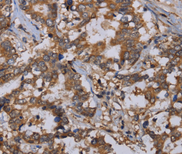 REG3G Polyclonal Antibody - 3