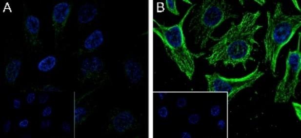 Recombinant alpha Tubulin (Acetyl K40) Monoclonal Antibody - small - 5