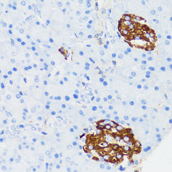 Immunohistochemistry of paraffin-embedded Mouse islets of langerhans using TLR2 Polyclonal Antibody at dilution of 1:150 (40x lens).