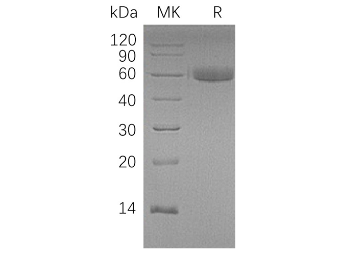 Recombinant Human HAO1 Protein (His Tag)