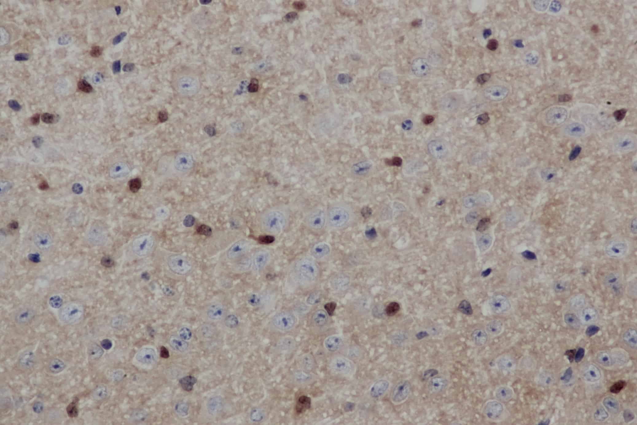 Immunohistochemistry of paraffin-embedded Mouse brain using ENO1 Polyclonal Antibody at dilution of 1:50