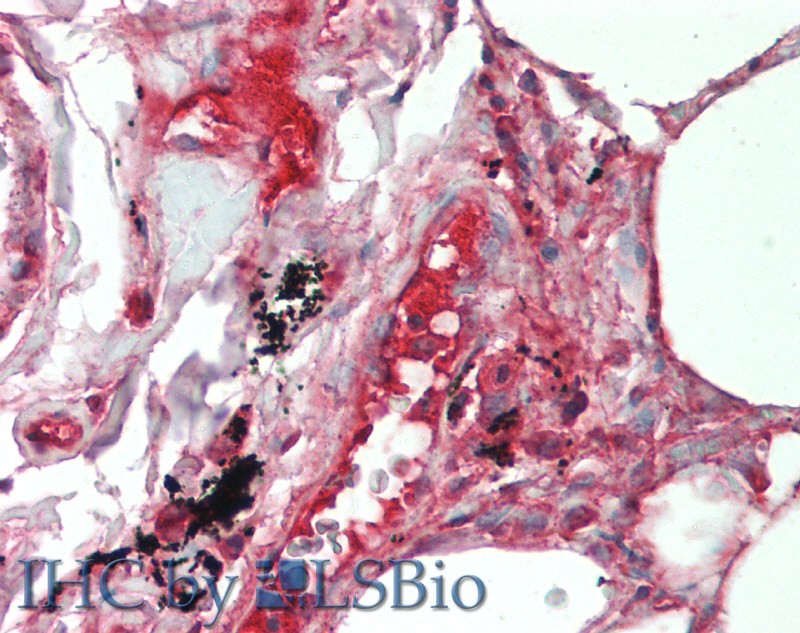 Immunohistochemistry of paraffin-embedded Lung tissue using IL19 Polyclonal Antibody at dilution of 1:90 (Elabscience Product Detected by Lifespan).