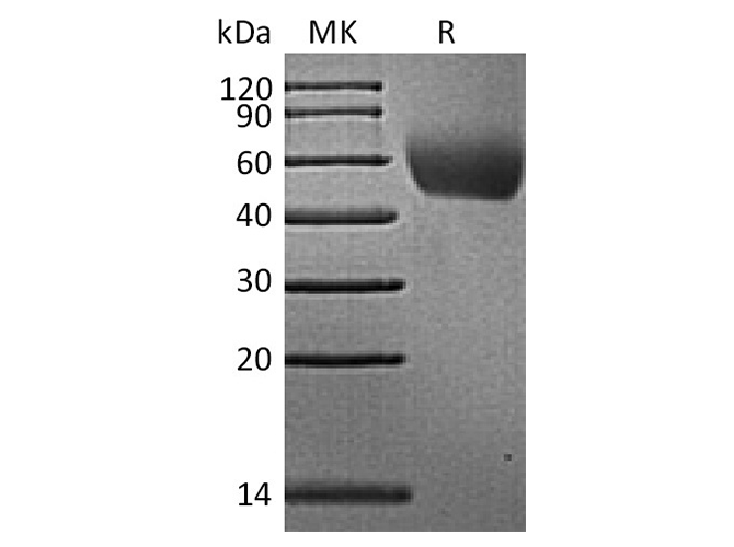 Recombinant Rhesus macaque CD155/PVR/NECL5 Protein (His Tag)