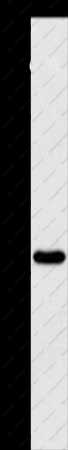 BCL10 Polyclonal Antibody - 1