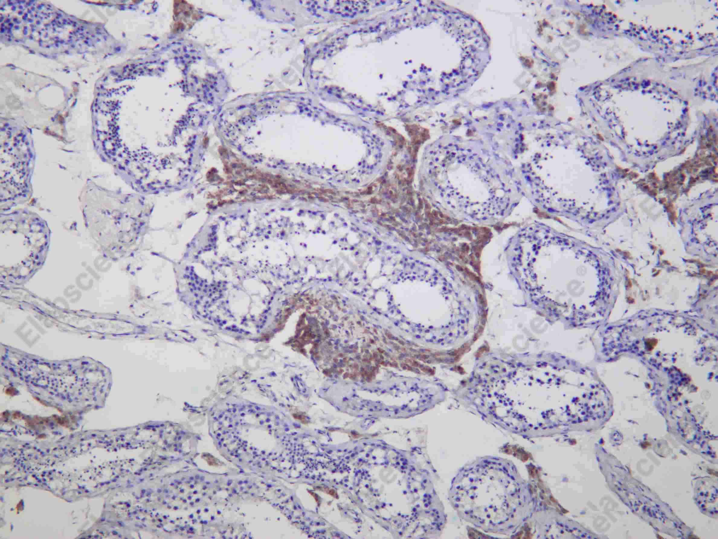 Recombinant CYP11A1 Monoclonal Antibody - 2