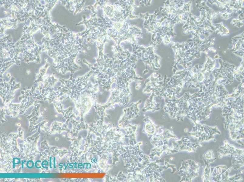 LS 174T [LS174T] Cell Complete Medium - 2