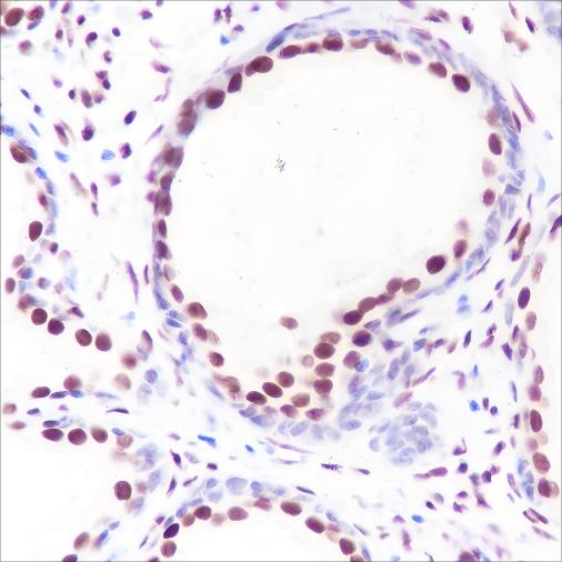 Recombinant Androgen Receptor (CT) Monoclonal Antibody - small - 2